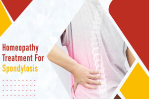 Read more about the article Homeopathy Treatment for Spondylosis