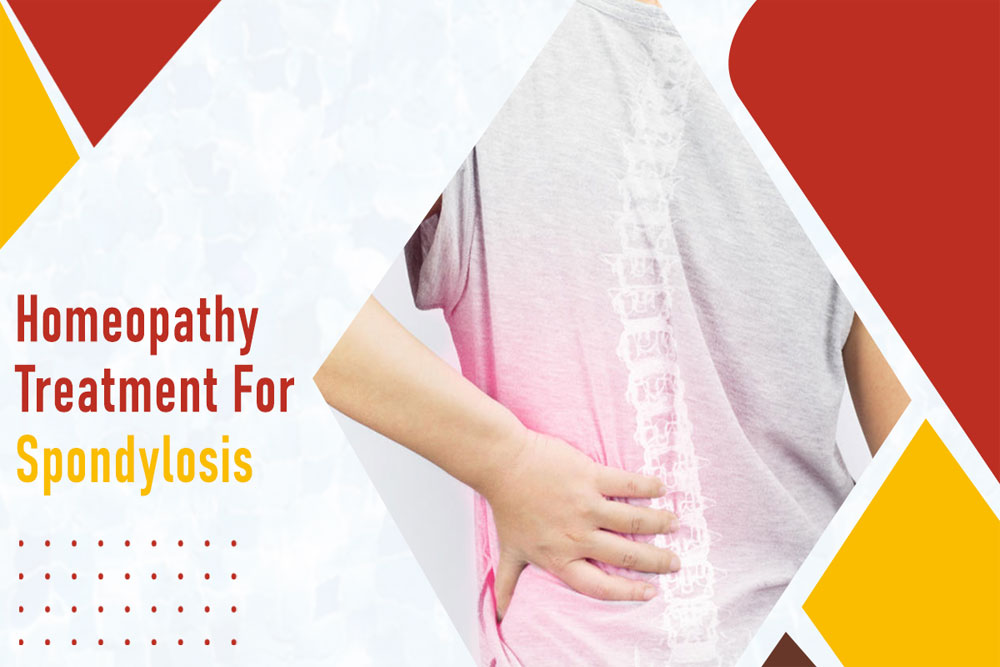 You are currently viewing Homeopathy Treatment for Spondylosis